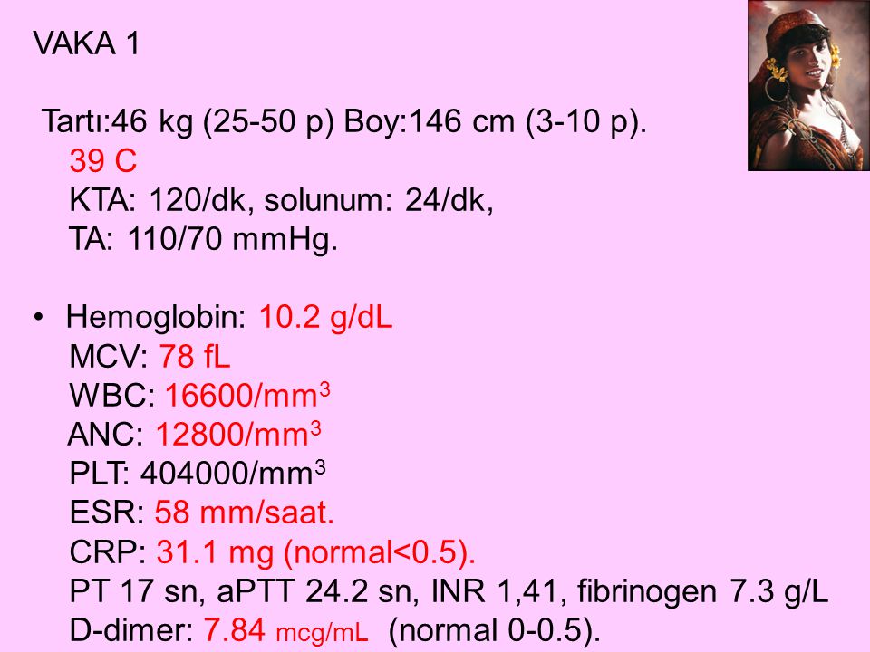 VAKA 1 Tartı:46 kg (25-50 p) Boy:146 cm (3-10 p).