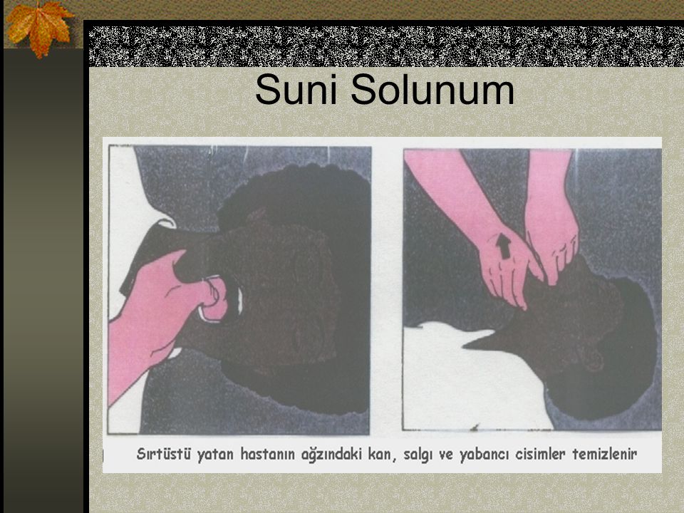 Suni Solunum