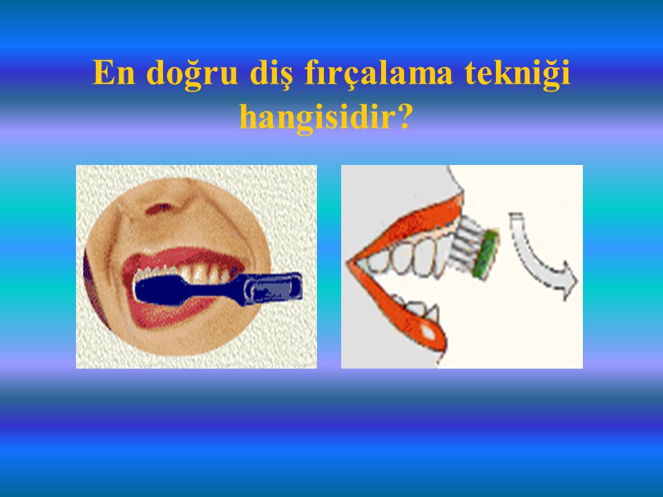 En doğru diş fırçalama tekniği hangisidir