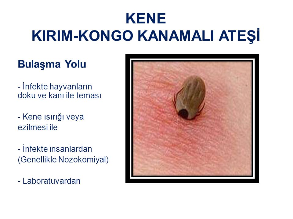KENE KIRIM-KONGO KANAMALI ATEŞİ Bulaşma Yolu - İnfekte hayvanların doku ve kanı ile teması - Kene ısırığı veya ezilmesi ile - İnfekte insanlardan (Genellikle Nozokomiyal) - Laboratuvardan