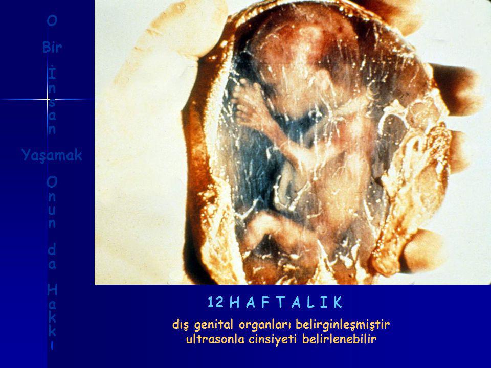 12 H A F T A L I K dış genital organları belirginleşmiştir ultrasonla cinsiyeti belirlenebilir O Bir İ n s a n Yaşamak O n u n d a H a k ı