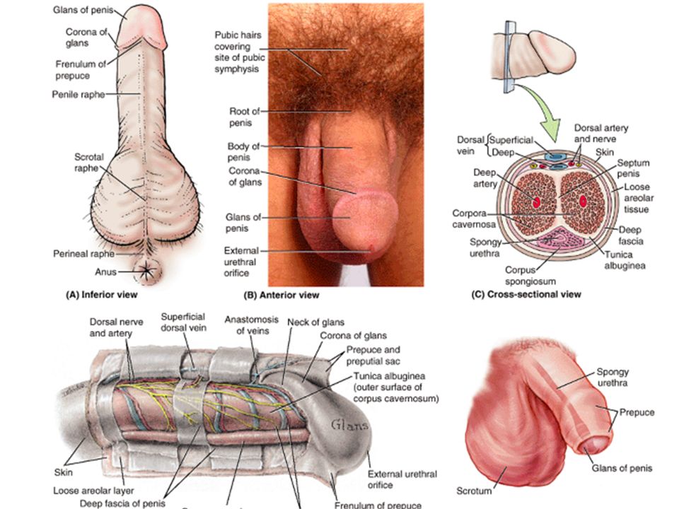 Skin abnormalities affecting the penis