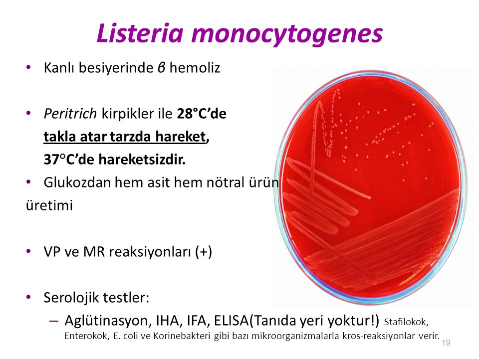 Listeria monocytogenes что это