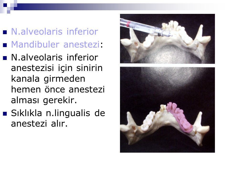 N.alveolaris inferior Mandibuler anestezi: N.alveolaris inferior anestezisi için sinirin kanala girmeden hemen önce anestezi alması gerekir.
