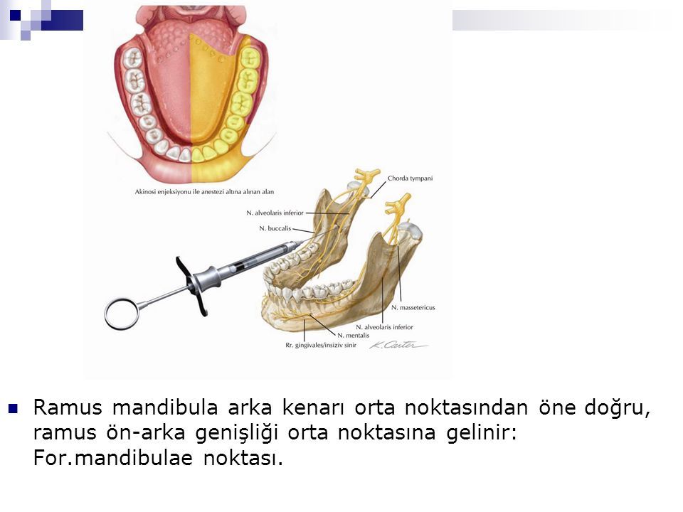 Ramus mandibula arka kenarı orta noktasından öne doğru, ramus ön-arka genişliği orta noktasına gelinir: For.mandibulae noktası.
