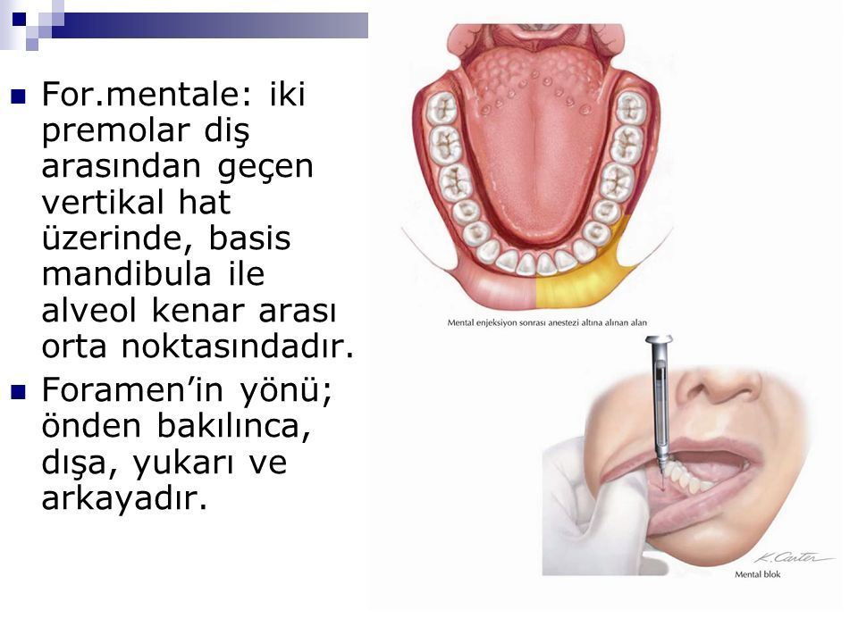 For.mentale: iki premolar diş arasından geçen vertikal hat üzerinde, basis mandibula ile alveol kenar arası orta noktasındadır.